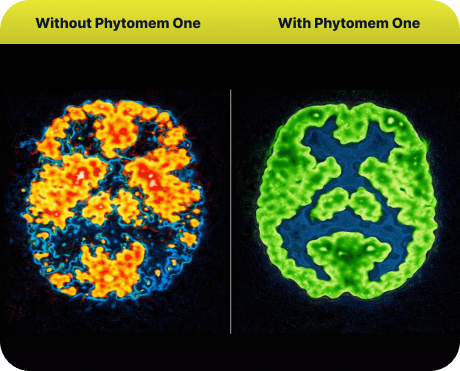 brain-before-after